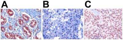 Immunohistochemistry: APE Antibody Pack [NB100-909]