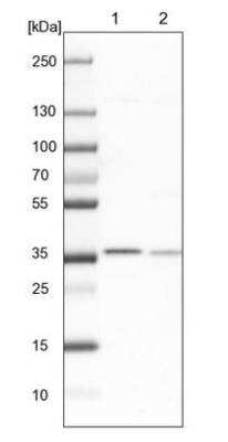 Western Blot: APE Antibody [NBP2-54653]