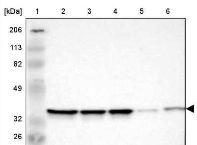 Western Blot: APE Antibody [NBP2-54653]