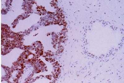 Immunohistochemistry: APE Antibody Pack [NB100-909]