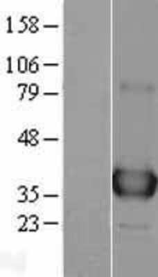 Western Blot: APE Overexpression Lysate [NBL1-07597]