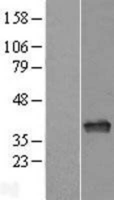 Western Blot: APE Overexpression Lysate [NBL1-07598]