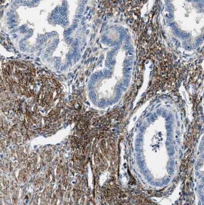 Immunohistochemistry-Paraffin: APEG1 Antibody [NBP1-90134]