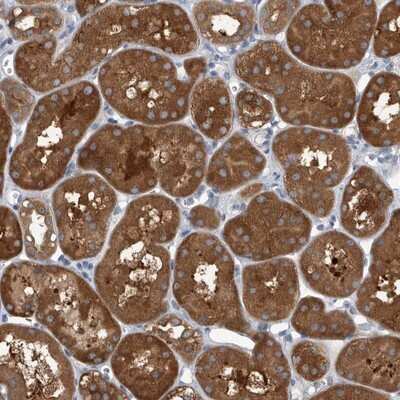 Immunohistochemistry-Paraffin: APEH Antibody [NBP1-85331]