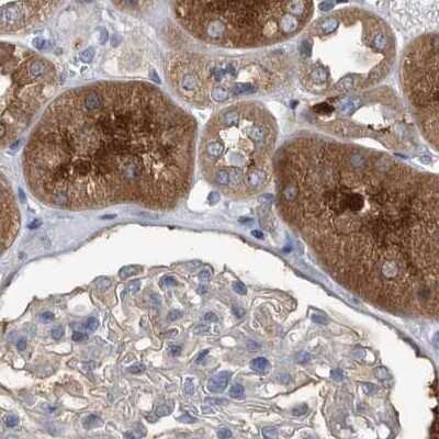 Immunohistochemistry-Paraffin: APEH Antibody [NBP1-85331]