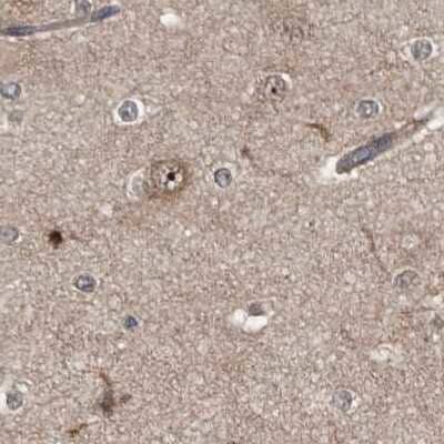 Immunohistochemistry-Paraffin: APEH Antibody [NBP1-85331]