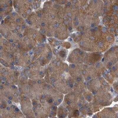 Immunohistochemistry-Paraffin: APEH Antibody [NBP1-85331]