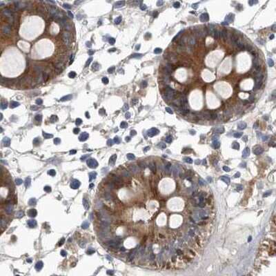 Immunohistochemistry-Paraffin: APEH Antibody [NBP1-85331]
