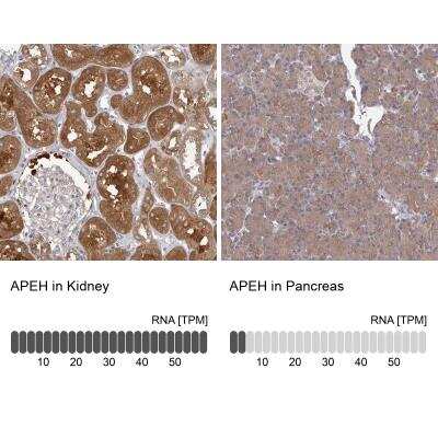 Immunohistochemistry-Paraffin: APEH Antibody [NBP1-85332]