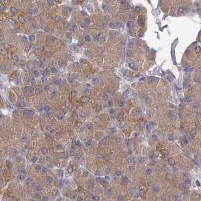 Immunohistochemistry-Paraffin: APEH Antibody [NBP1-85332]
