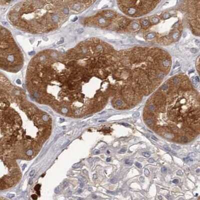 Immunohistochemistry-Paraffin: APEH Antibody [NBP1-85332]
