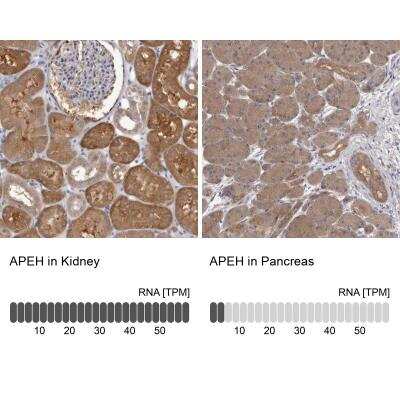 Immunohistochemistry-Paraffin: APEH Antibody [NBP1-85333]