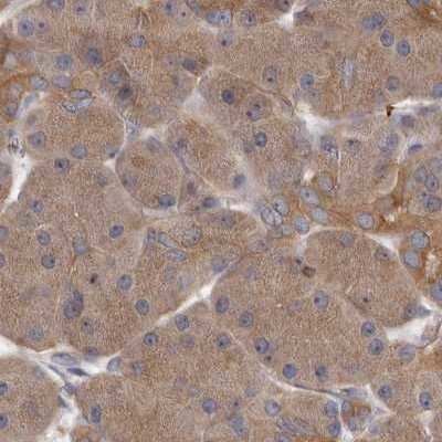 Immunohistochemistry-Paraffin: APEH Antibody [NBP1-85333]