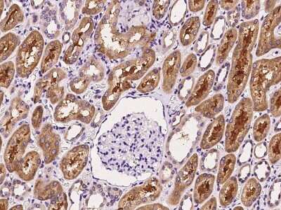 Immunohistochemistry-Paraffin: APEH Antibody [NBP2-99357]