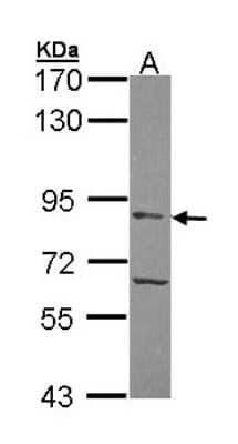 Western Blot: APEH Antibody [NBP1-33676]