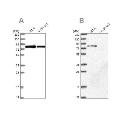 Western Blot: APEH Antibody [NBP1-85332]