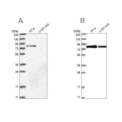 Western Blot: APEH Antibody [NBP1-85333]