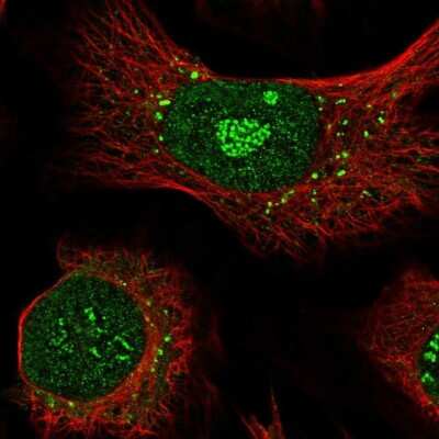 Immunocytochemistry/ Immunofluorescence: APEX2 Antibody [NBP2-58257]