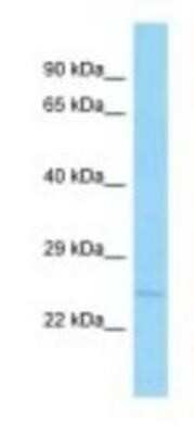 Western Blot: APH1B Antibody [NBP1-98414]