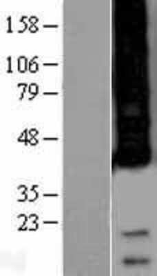 Western Blot: APH1A Overexpression Lysate [NBP2-04350]