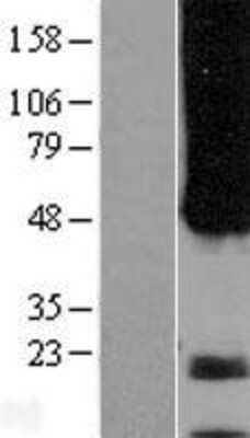 Western Blot: APH1A Overexpression Lysate [NBP2-08465]