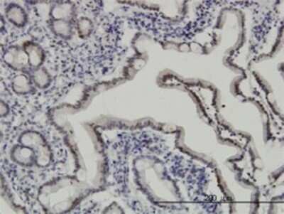 Immunohistochemistry-Paraffin: API5 Antibody (1C2) [H00008539-M01]