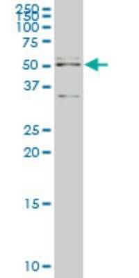 Western Blot: API5 Antibody (1C2) [H00008539-M01]