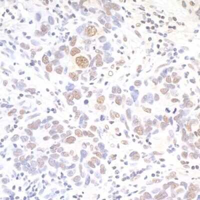 Immunohistochemistry-Paraffin: API5 Antibody [NBP1-46223]