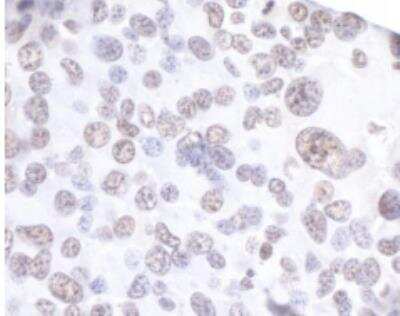 Immunohistochemistry-Paraffin: API5 Antibody [NBP1-46223]