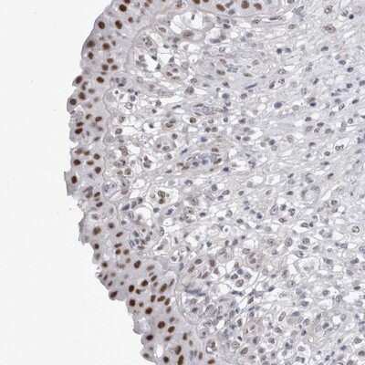 Immunohistochemistry-Paraffin: API5 Antibody [NBP1-89326]