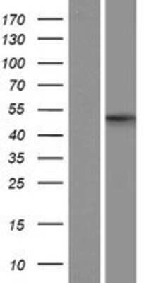 Western Blot: API5 Overexpression Lysate [NBP2-09675]