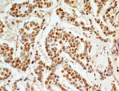 Immunohistochemistry-Paraffin: APIP Antibody (19F461) - Azide Free [NBP2-33231]