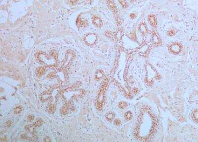 Immunohistochemistry-Paraffin: APIP Antibody (19F461) - Azide Free [NBP2-33231]