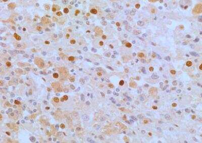 Immunohistochemistry-Paraffin: APIP Antibody (19F461) - Azide Free [NBP2-33231]