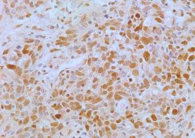 Immunohistochemistry-Paraffin: APIP Antibody (19F461) - Azide Free [NBP2-33231]
