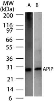 Western Blot: APIP Antibody (19F461) [NB100-56567]