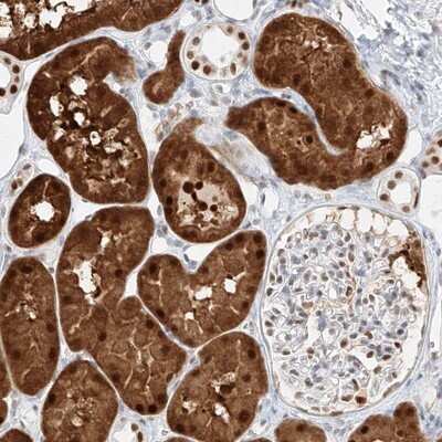 Immunohistochemistry-Paraffin: APIP Antibody [NBP1-89039]
