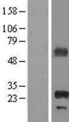 Western Blot: APIP Overexpression Lysate [NBL1-07603]