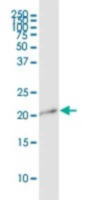 Western Blot: APITD1 Antibody [H00378708-B01P]