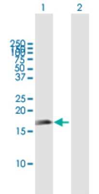 Western Blot: APITD1 Antibody [H00378708-B01P]
