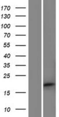 Western Blot: APITD1 Overexpression Lysate [NBP2-10083]