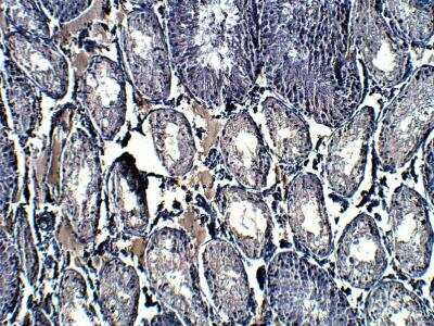 Immunohistochemistry-Paraffin: APJ/Apelin receptor Antibody [NBP3-12283]