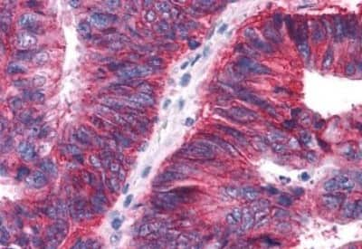 Immunohistochemistry-Paraffin: APJ/Apelin receptor Antibody [NBP3-14541]