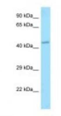 Western Blot: APJ/Apelin receptor Antibody [NBP1-98465]