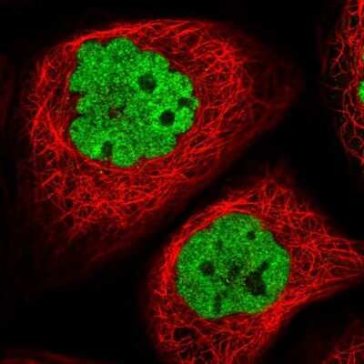 Immunocytochemistry/ Immunofluorescence: APLF Antibody [NBP2-38212]