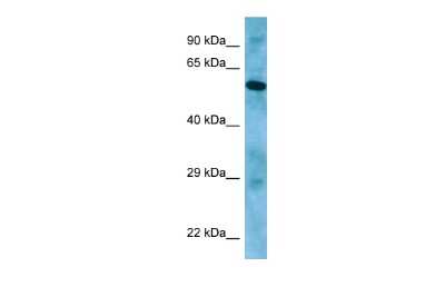 Western Blot: APLF Antibody [NBP2-84442]