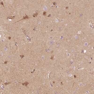 Immunohistochemistry-Paraffin: APLP-1 Antibody [NBP1-89036]