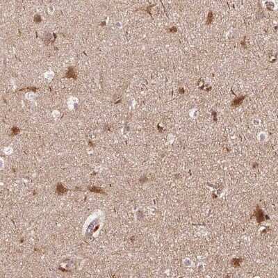 Immunohistochemistry-Paraffin: APLP-1 Antibody [NBP2-38140]
