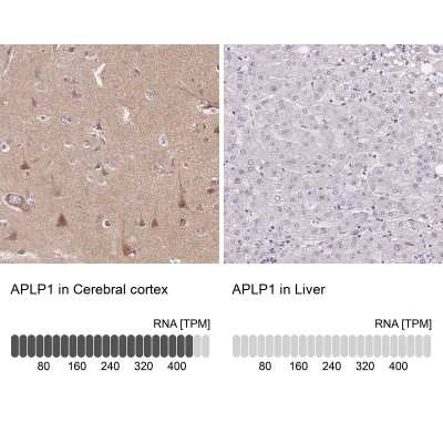 Immunohistochemistry-Paraffin: APLP-1 Antibody [NBP2-38140]