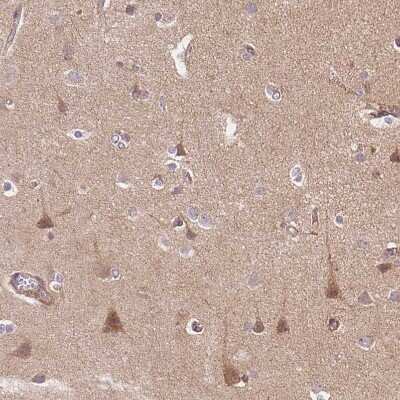 Immunohistochemistry-Paraffin: APLP-1 Antibody [NBP2-38140]